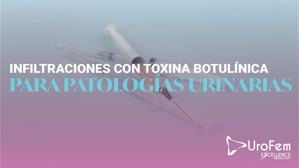 infiltracion toxina botulinica urologia excellence urology